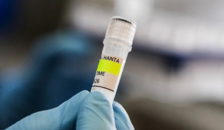 UK identifies new suspected hantavirus case on remote island